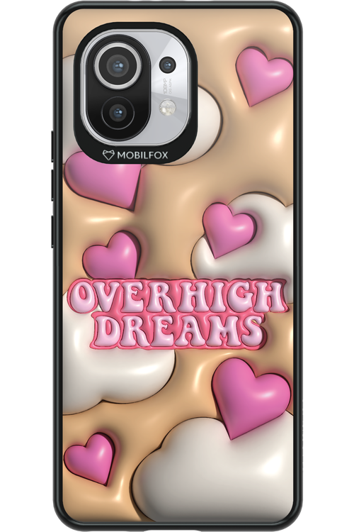 Overhigh Dreams - Xiaomi Mi 11 5G