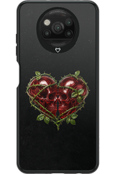 Omen Kiss 2.0 - Xiaomi Poco X3 Pro