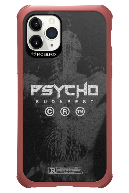 X-Ray - Apple iPhone 11 Pro