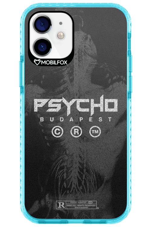 X-Ray - Apple iPhone 12