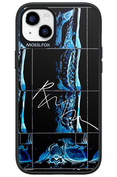 RMN Scolioza 2.0 - Apple iPhone 14 Plus