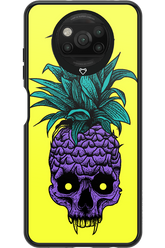 Pineapple Skull - Xiaomi Poco X3 Pro