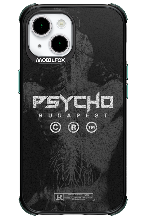 X-Ray - Apple iPhone 15