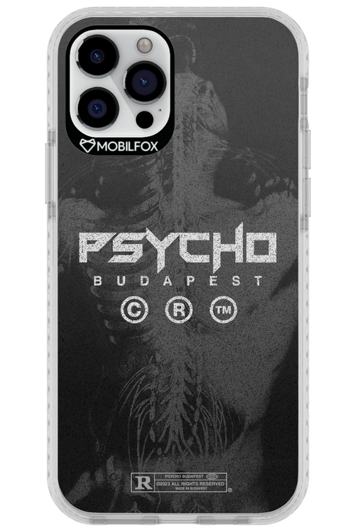 X-Ray - Apple iPhone 12 Pro