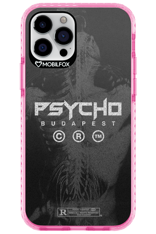 X-Ray - Apple iPhone 12 Pro