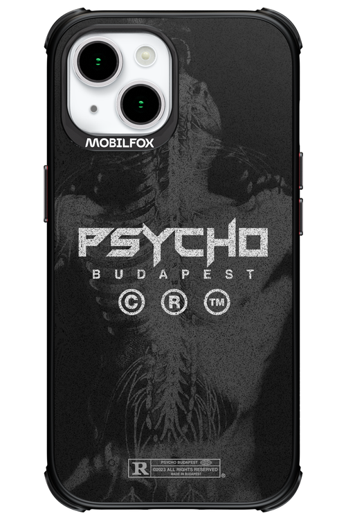 X-Ray - Apple iPhone 15