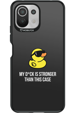 My D_ck 2.0 - Xiaomi Mi 11 Lite (2021)