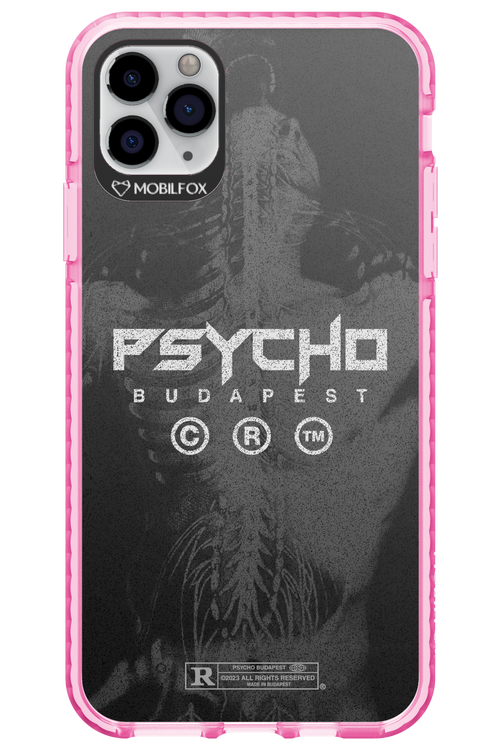 X-Ray - Apple iPhone 11 Pro Max
