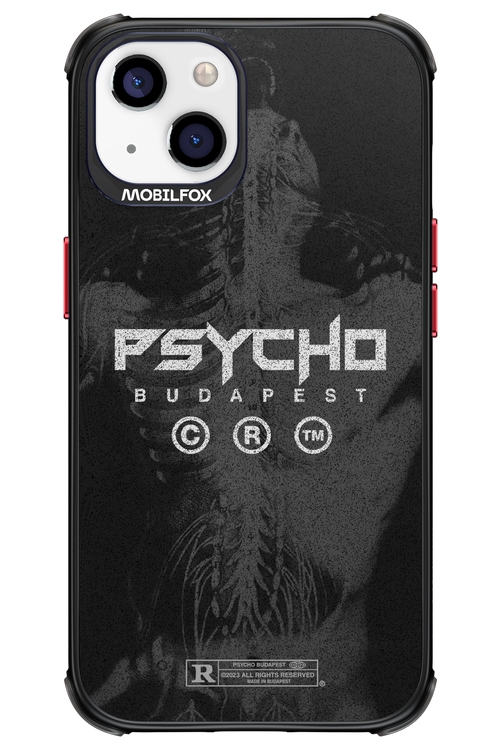 X-Ray - Apple iPhone 13
