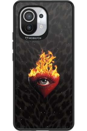 Shit happens - Xiaomi Mi 11 5G