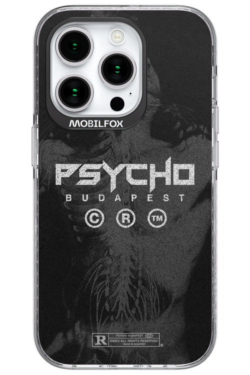 X-Ray - Apple iPhone 15 Pro