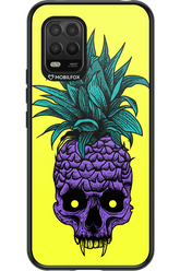 Pineapple Skull - Xiaomi Mi 10 Lite 5G