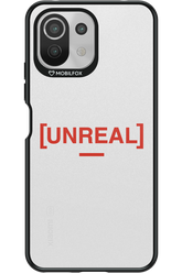 Unreal Classic - Xiaomi Mi 11 Lite (2021)