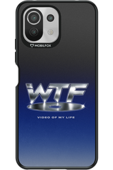 W T F 2.0 - Xiaomi Mi 11 Lite (2021)