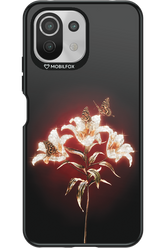 Glow Up Girl 2.0 - Xiaomi Mi 11 Lite (2021)
