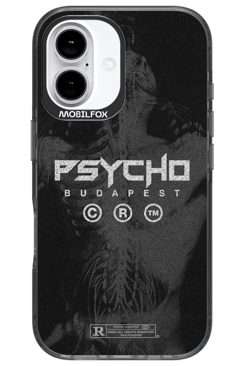 X-Ray - Apple iPhone 16