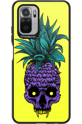 Pineapple Skull - Xiaomi Redmi Note 10