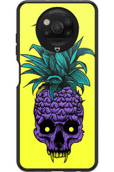 Pineapple Skull - Xiaomi Poco X3 NFC