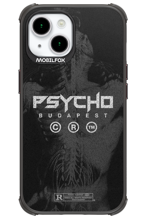 X-Ray - Apple iPhone 15