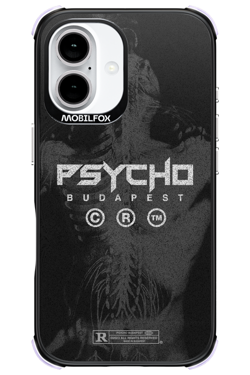 X-Ray - Apple iPhone 16