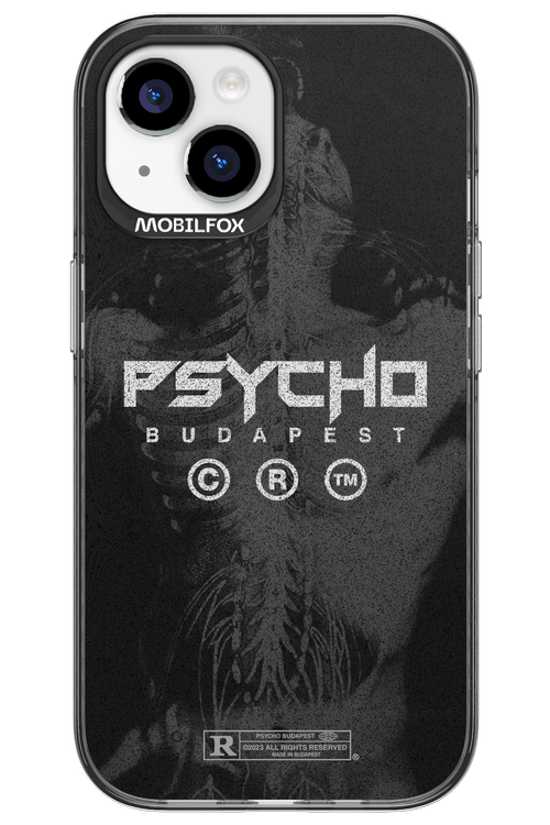 X-Ray - Apple iPhone 15