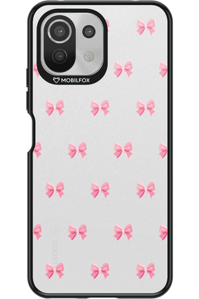 Pinky Bow 2.0 - Xiaomi Mi 11 Lite (2021)