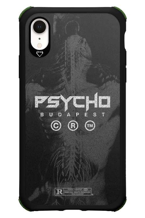 X-Ray - Apple iPhone XR