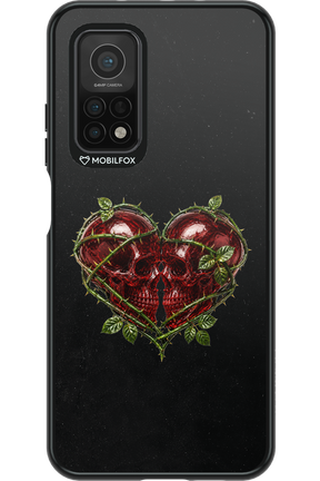 Omen Kiss 2.0 - Xiaomi Mi 10T 5G
