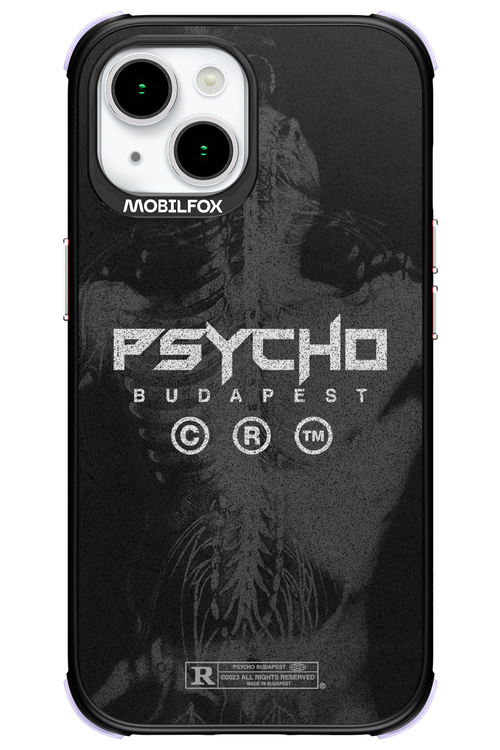 X-Ray - Apple iPhone 15