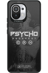 X-Ray - Xiaomi Mi 11 5G