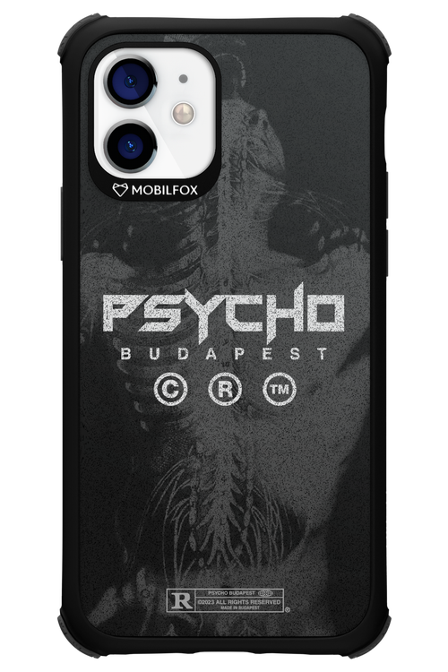 X-Ray - Apple iPhone 12