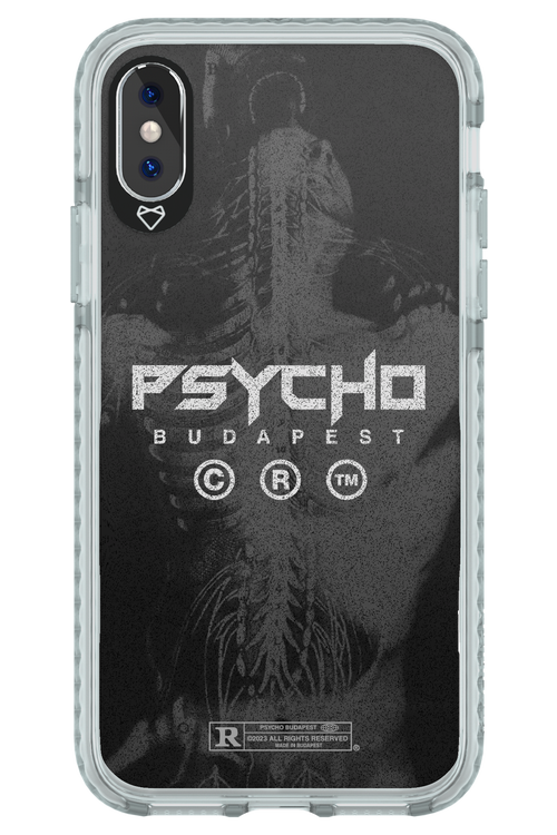 X-Ray - Apple iPhone XS