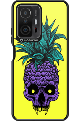 Pineapple Skull - Xiaomi Mi 11T