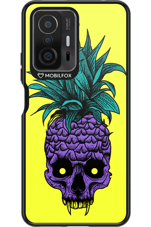 Pineapple Skull - Xiaomi Mi 11T