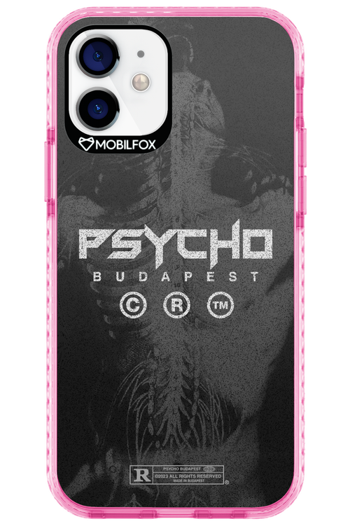 X-Ray - Apple iPhone 12