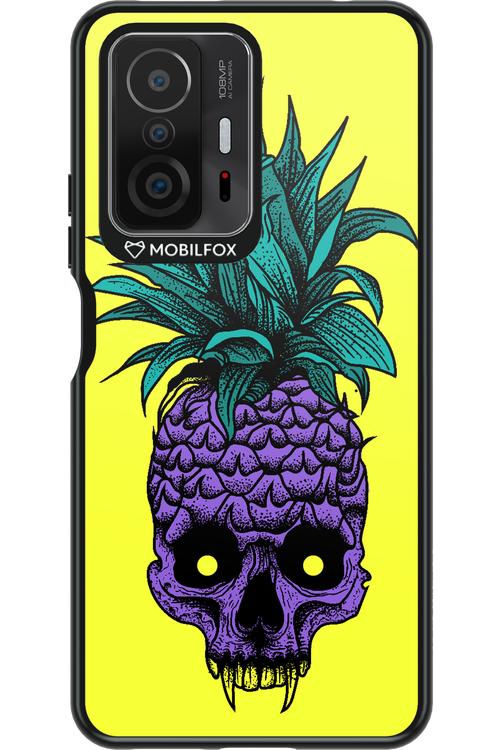 Pineapple Skull - Xiaomi Mi 11T Pro