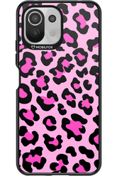 PINK LEOPARD 2.0 - Xiaomi Mi 11 Lite (2021)
