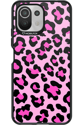 PINK LEOPARD 2.0 - Xiaomi Mi 11 Lite (2021)