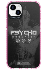 X-Ray - Apple iPhone 14 Plus