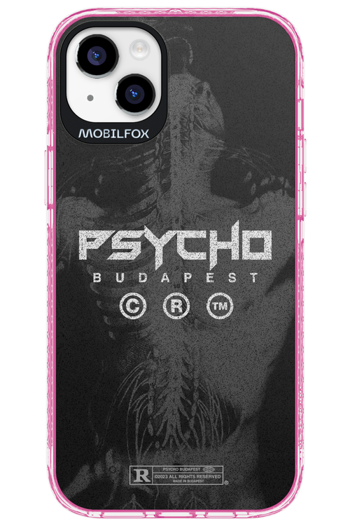 X-Ray - Apple iPhone 14 Plus