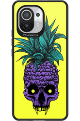 Pineapple Skull - Xiaomi Mi 11 5G