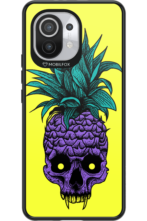 Pineapple Skull - Xiaomi Mi 11 5G