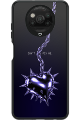 Don't fix me 2.0 - Xiaomi Poco X3 NFC
