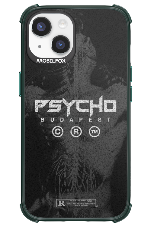 X-Ray - Apple iPhone 14
