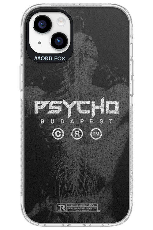 X-Ray - Apple iPhone 14 Plus