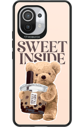 Sweet Inside 2.0 - Xiaomi Mi 11 5G