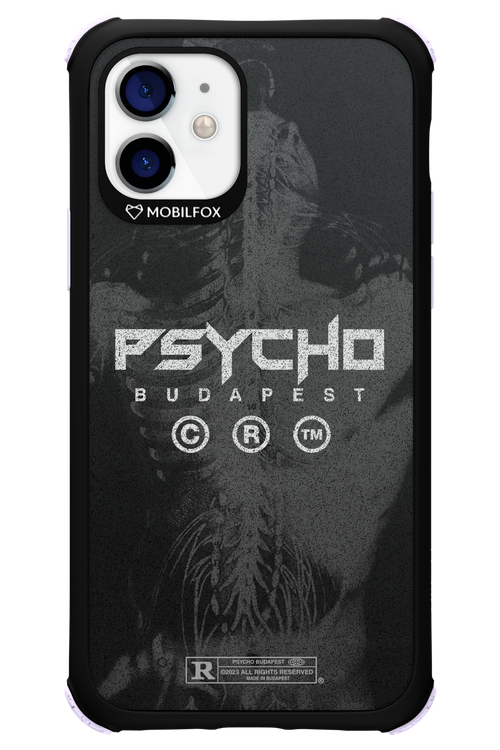 X-Ray - Apple iPhone 12