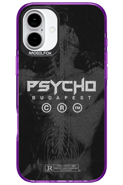 X-Ray - Apple iPhone 16 Plus