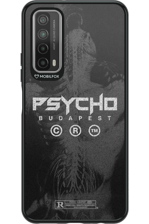 X-Ray - Huawei P Smart 2021