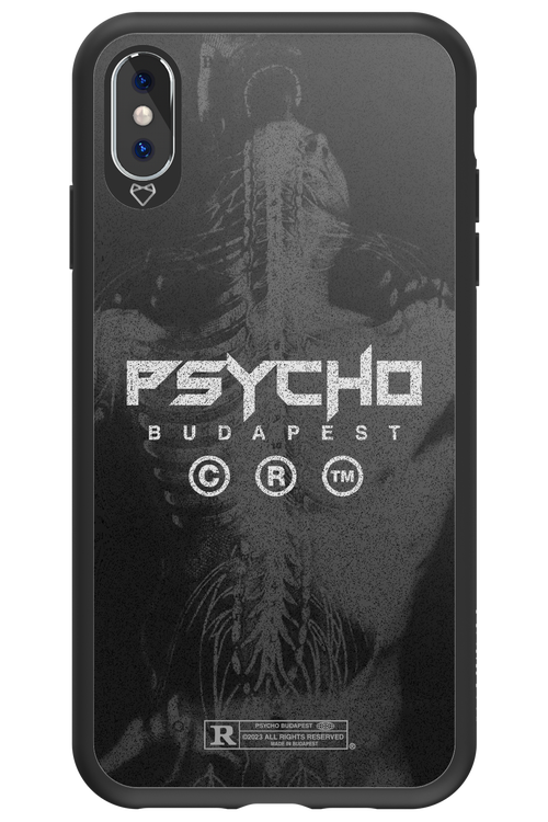 X-Ray - Apple iPhone XS Max